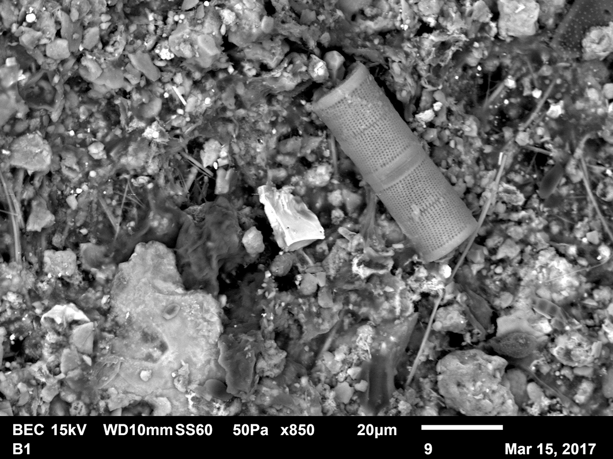 observacion microscopio